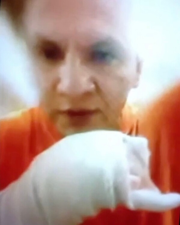 In this image from video provided by Xiomara Ochoa, Juan Antonio Pineda shows a cast for his arm as he speaks during an interview from the ICE detention center in Florence, Ariz., on Sept. 29, 2025 .(Xiomara Ochoa via AP)